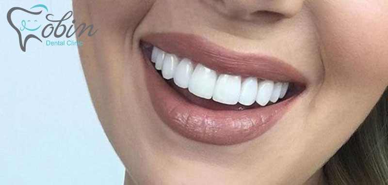 روش زیبایی دندان